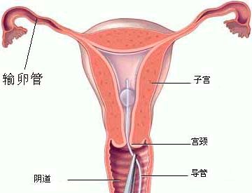 子宫内膜变薄的原因有哪些